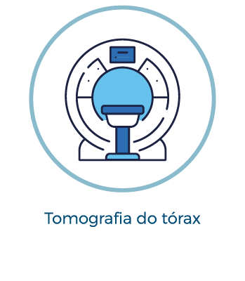 Tomografia do tórax